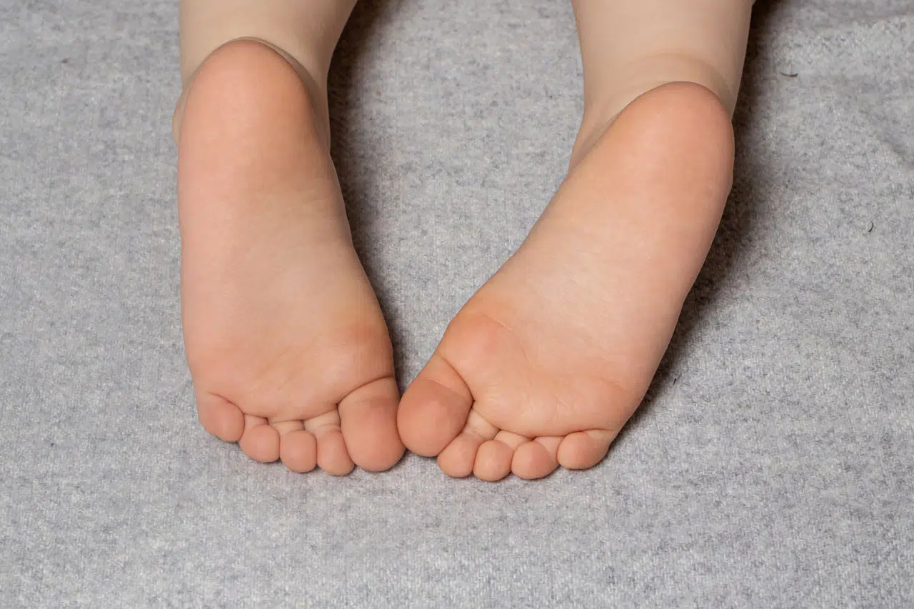 Pie de foto: Podólogo examinando los pies de un bebé